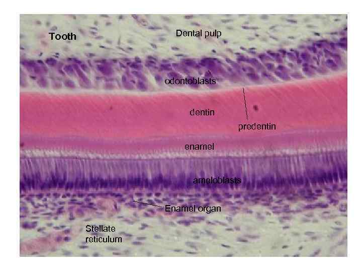 Dental pulp Tooth odontoblasts dentin predentin enameloblasts Enamel organ Stellate reticulum 