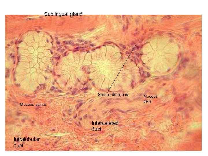 Sublingual gland Serous demilune Mucous acinus Intercalated duct Intralobular duct Mucous cells 