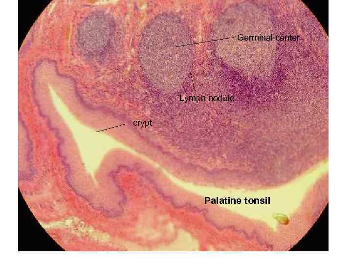 Germinal center Lymph nodule crypt Palatine tonsil 