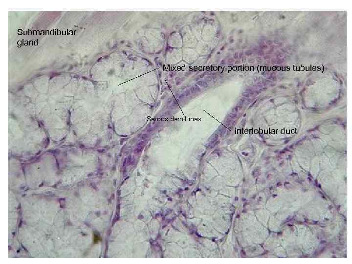 Submandibular gland Mixed secretory portion (mucous tubules) Serous demilunes interlobular duct 