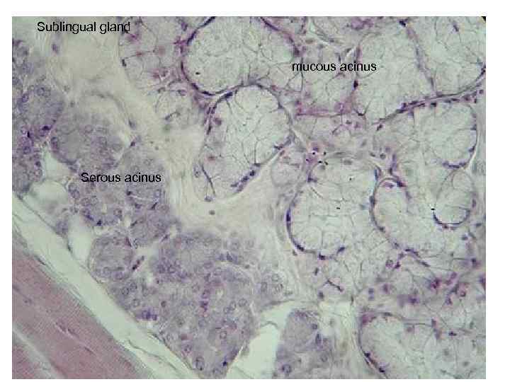 Sublingual gland mucous acinus Serous acinus 