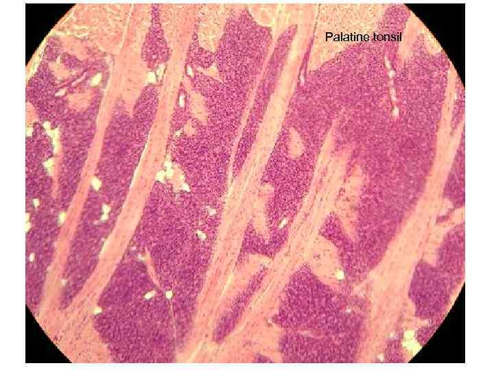 Palatine tonsil 