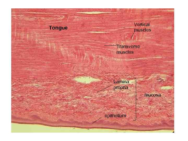 Vertical muscles Tongue Transverse muscles Lamina propria mucosa epithelium 