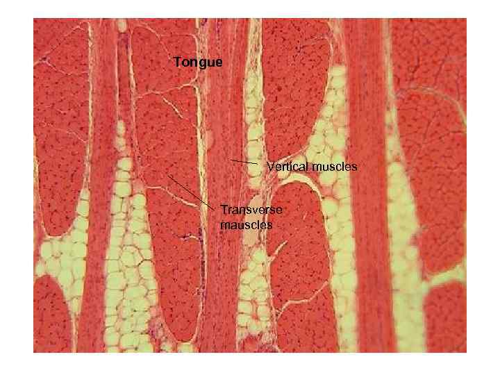 Tongue Vertical muscles Transverse mauscles 