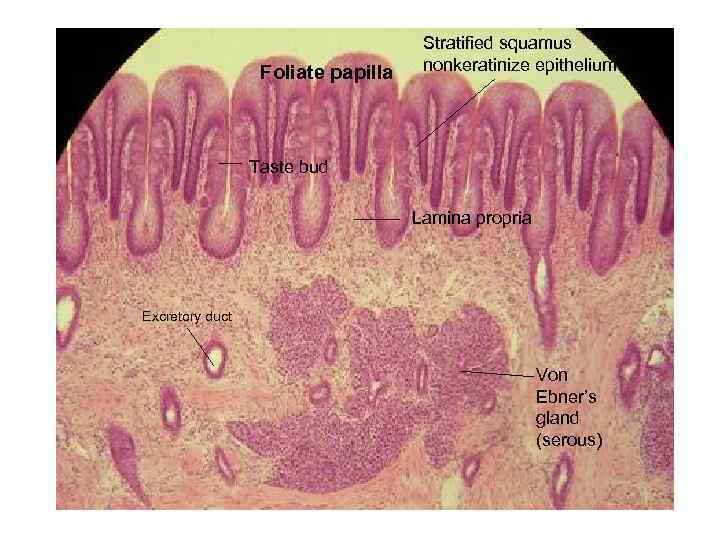 Foliate papilla Stratified squamus nonkeratinize epithelium Taste bud Lamina propria Excretory duct Von Ebner’s