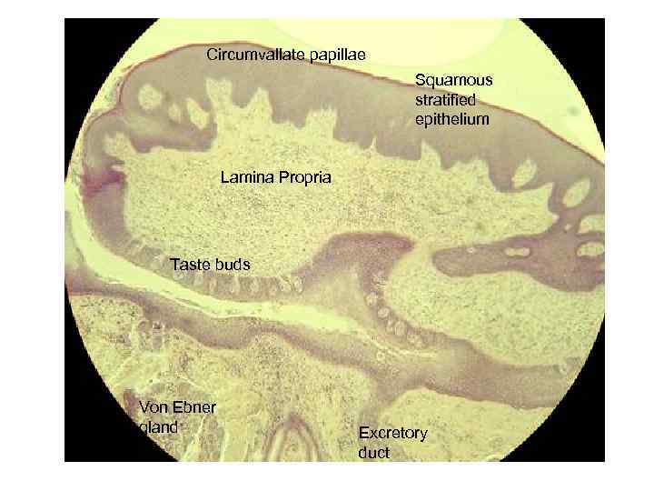 Circumvallate papillae Squamous stratified epithelium Lamina Propria Taste buds Von Ebner gland Excretory duct