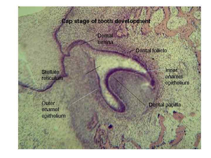 Cap stage of tooth development Dental lamina Dental follicle Stellate reticulum Outer enamel epithelium