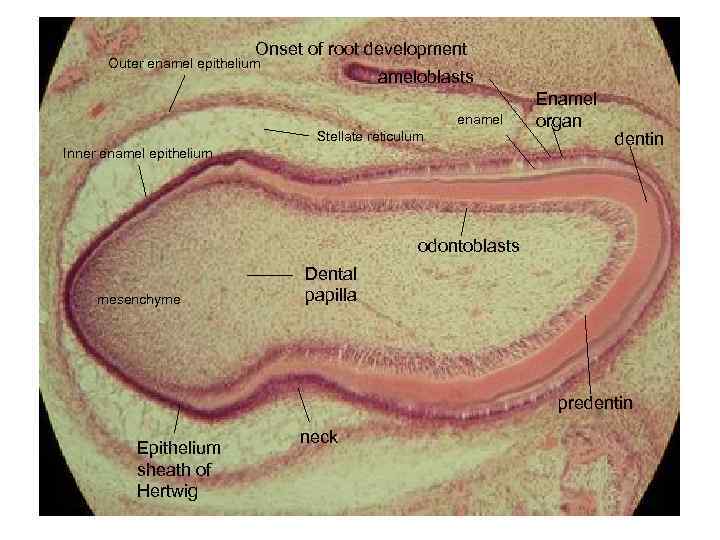 Onset of root development Outer enamel epithelium ameloblasts enamel Stellate reticulum Inner enamel epithelium