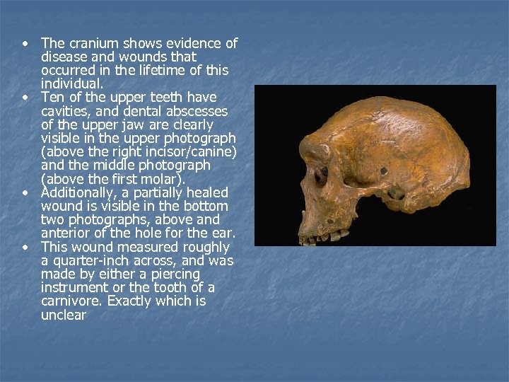  • The cranium shows evidence of disease and wounds that occurred in the