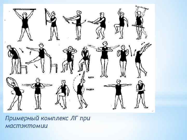 Комплекс упражнений после мастэктомии