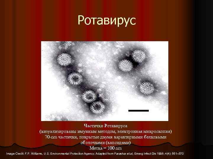 Ротавирус Частички Ротавируса (визуализированы имунным методом, электронная микроскопия) 70 -nm частички, покрытые двумя характерными