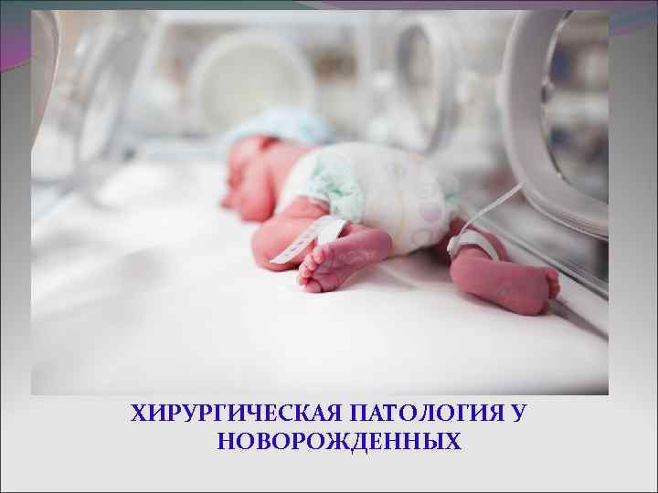 ХИРУРГИЧЕСКАЯ ПАТОЛОГИЯ У НОВОРОЖДЕННЫХ 