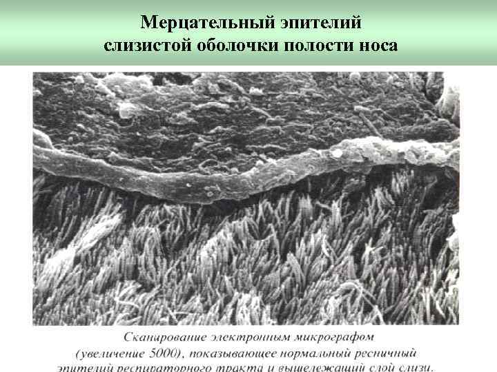Мерцательный эпителий слизистой оболочки полости носа 