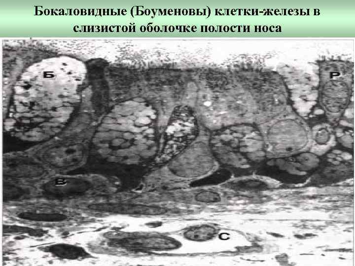 Бокаловидные (Боуменовы) клетки-железы в слизистой оболочке полости носа 