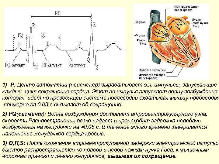 Пейсмекер