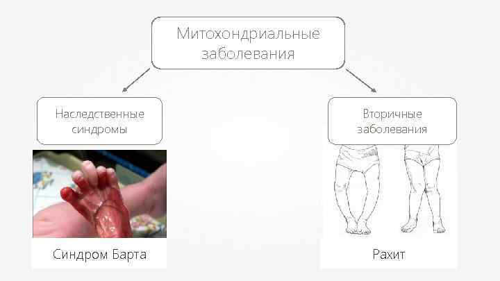 Митохондриальные заболевания Наследственные синдромы Синдром Барта Вторичные заболевания Рахит 