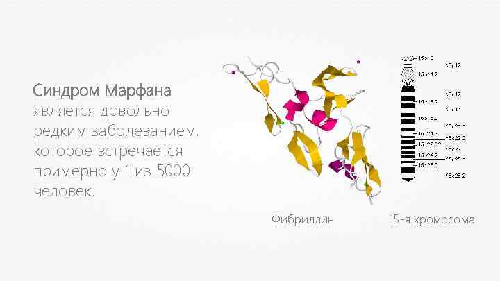 Синдром Марфана является довольно редким заболеванием, которое встречается примерно у 1 из 5000 человек.