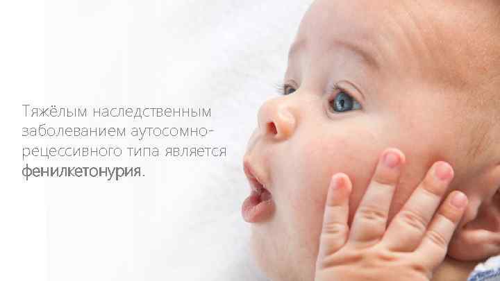 Тяжёлым наследственным заболеванием аутосомнорецессивного типа является фенилкетонурия. 