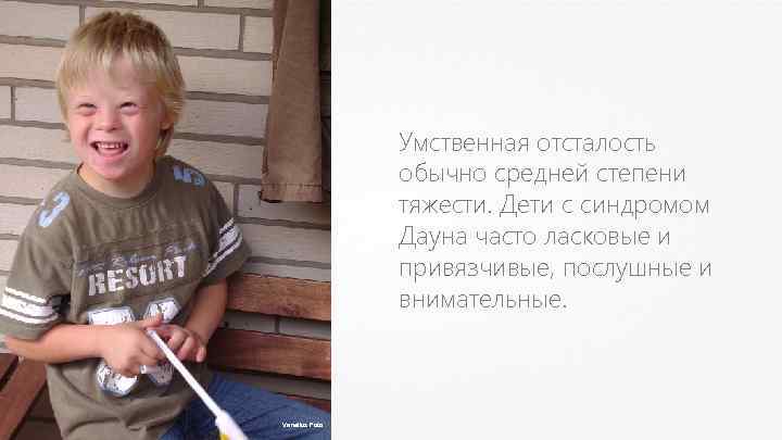 Умственная отсталость обычно средней степени тяжести. Дети с синдромом Дауна часто ласковые и привязчивые,
