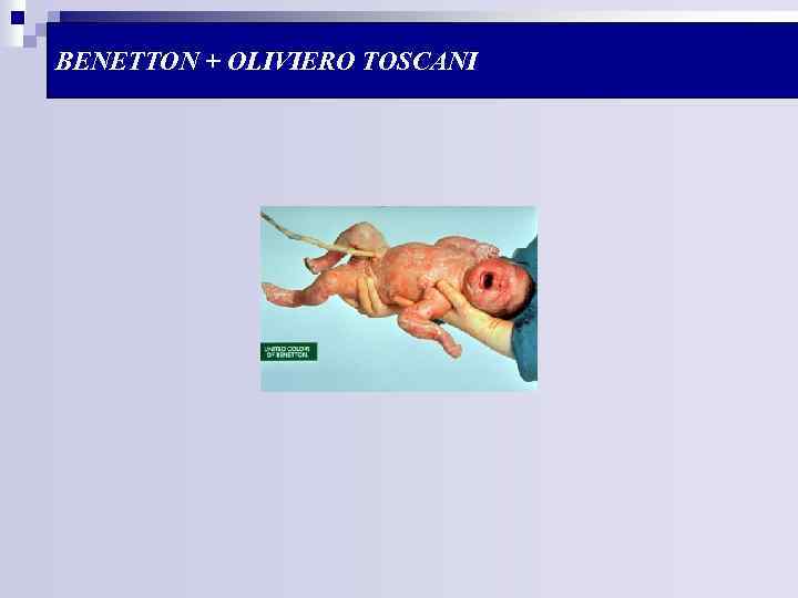 BENETTON + OLIVIERO TOSCANI 