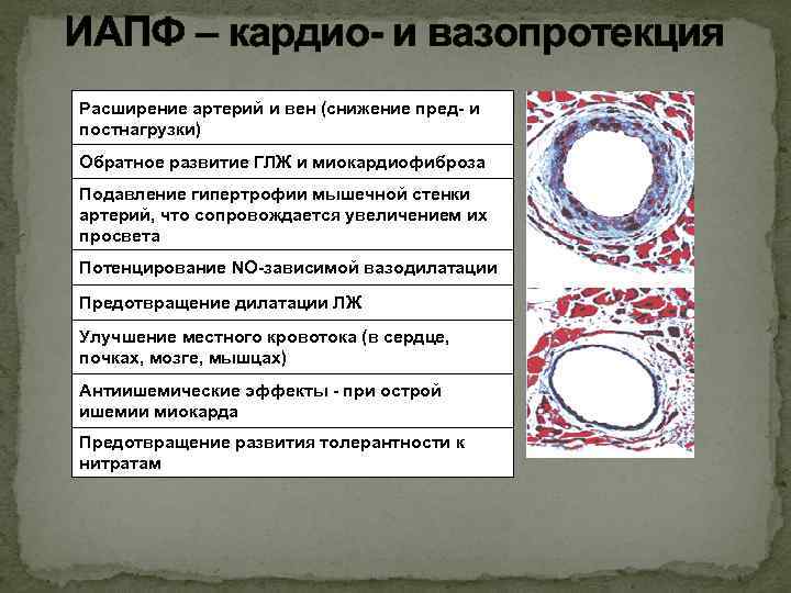 ИАПФ – кардио- и вазопротекция Расширение артерий и вен (снижение пред- и постнагрузки) Обратное