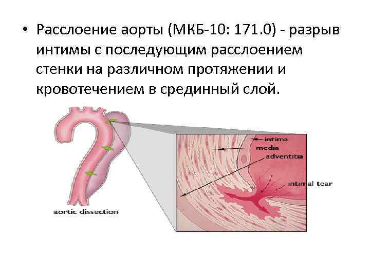 Ригидность сосудистой стенки