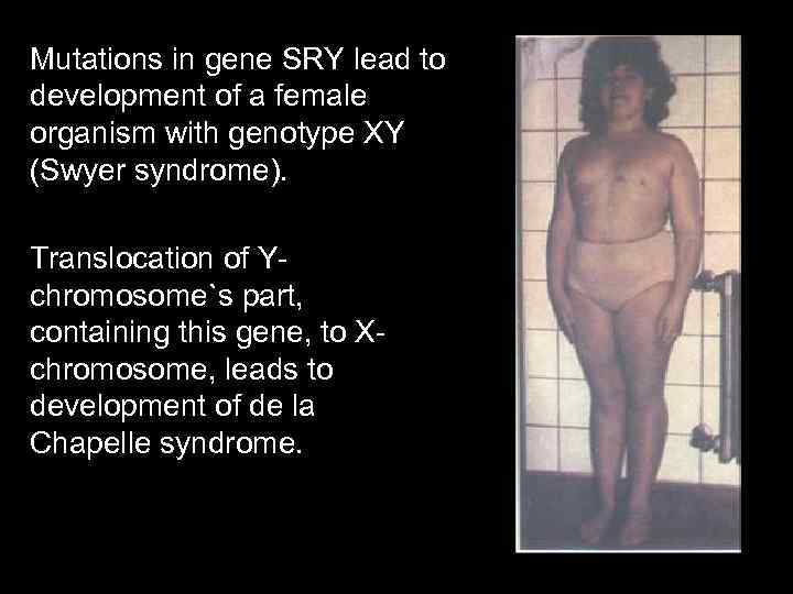 Mutations in gene SRY lead to development of a female organism with genotype XY