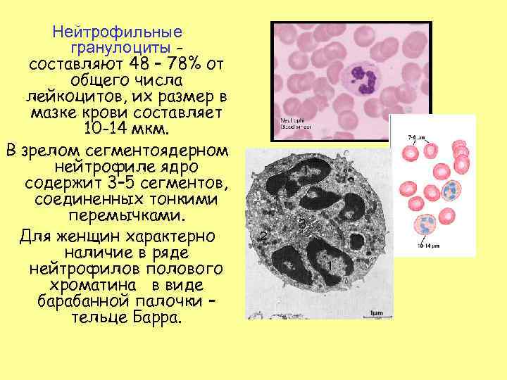 Пониженные нейтрофилы сегментоядерные в крови у женщин