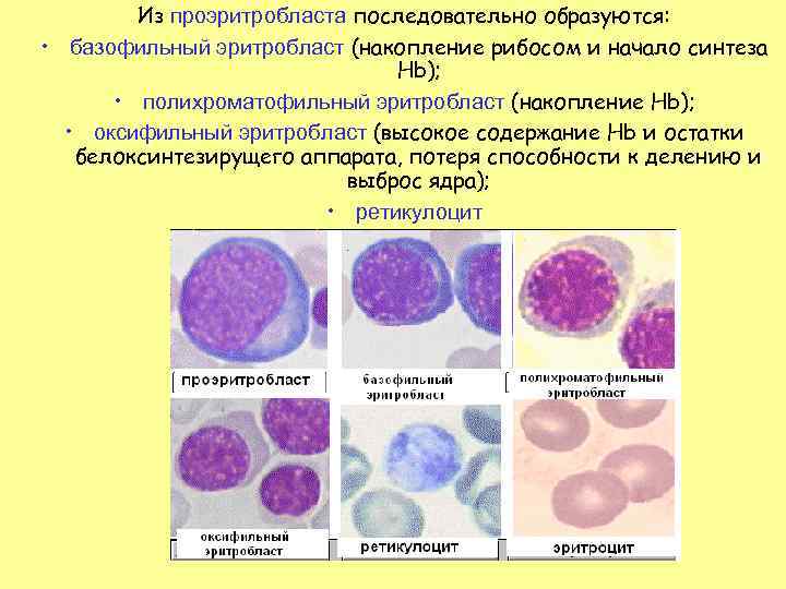 Нормобласты. Полихроматофильный эритробласт. Оксифильные нормоциты. Эритробласт пронормоцит. Базофильный нормоцит.