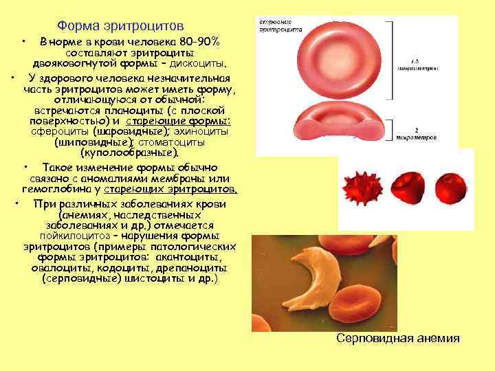 Форма эритроцитов • В норме в крови человека 80 -90% составляют эритроциты двояковогнутой формы