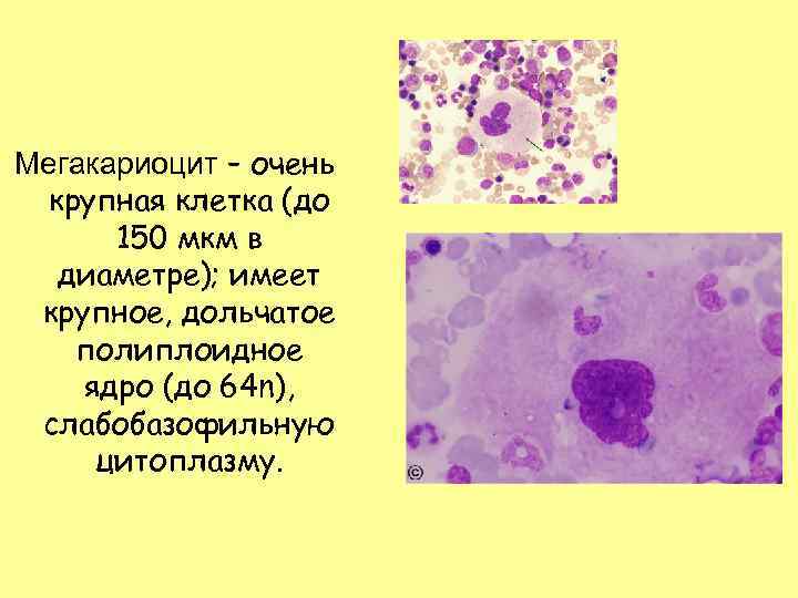 Мегакариоцит – очень крупная клетка (до 150 мкм в диаметре); имеет крупное, дольчатое полиплоидное