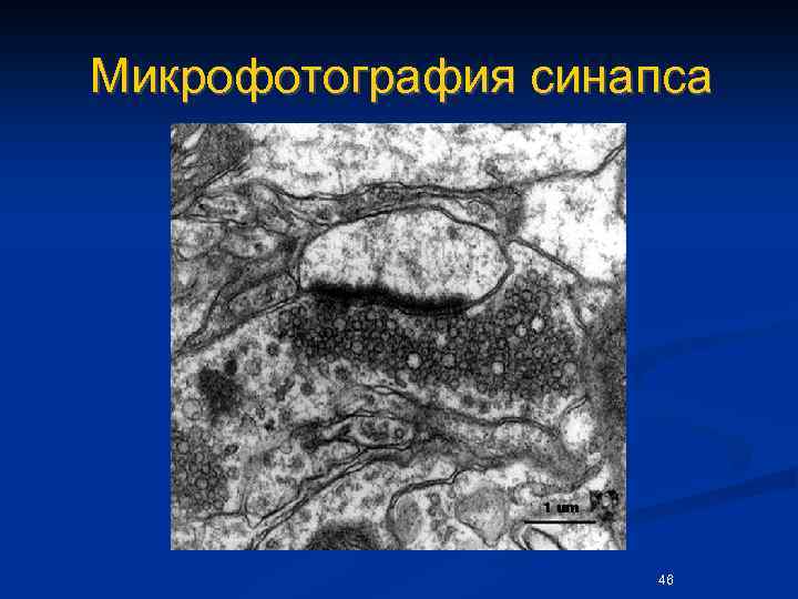Микрофотография синапса 46 
