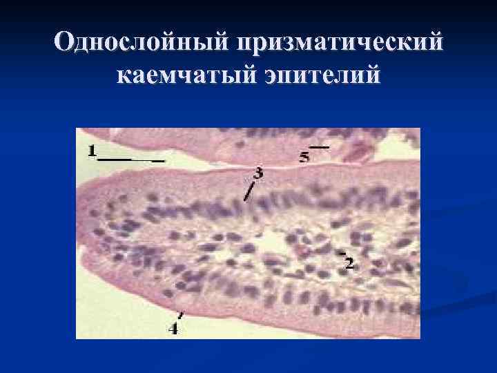 Однослойный призматический каемчатый эпителий