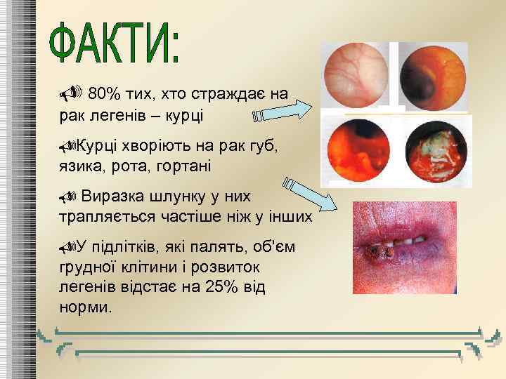  80% тих, хто страждає на рак легенів – курці Курці хворіють на рак