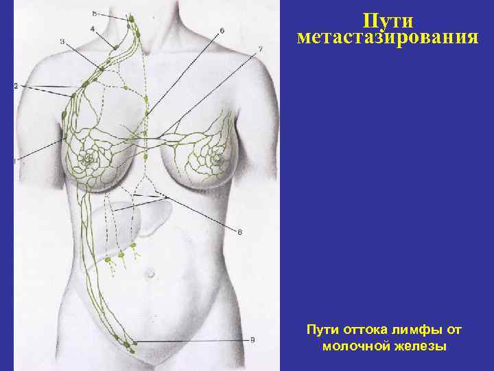 Пути метастазирования Пути оттока лимфы от молочной железы 