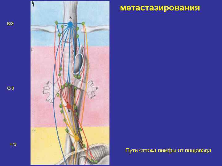 1 метастазирования В/3 С/3 Н/3 Пути оттока лимфы от пищевода 