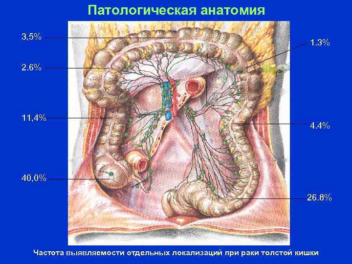 Патологическая анатомия 3, 5% 1. 3% 2. 6% 11, 4% 40, 0% 26. 8%