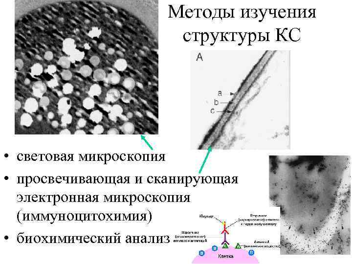 Преимущество использования световой микроскопии перед электронной. Сканирующая и просвечивающая электронная микроскопия. Световая микроскопия электронная и сканирующая. Методы изучения клетки электронная микроскопия. Методы цитологии электронная микроскопия.