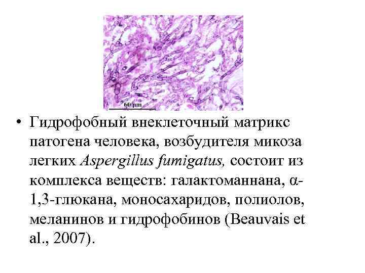  • Гидрофобный внеклеточный матрикс патогена человека, возбудителя микоза легких Aspergillus fumigatus, состоит из