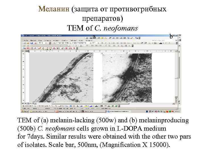 Меланин (защита от противогрибных препаратов) TEM of C. neofomans a b TEM of (a)