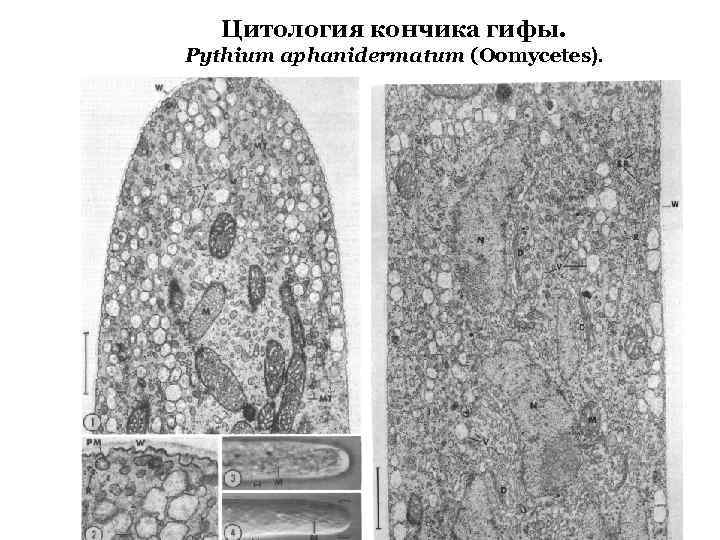 Цитология кончика гифы. Pythium aphanidermatum (Oomycetes). 