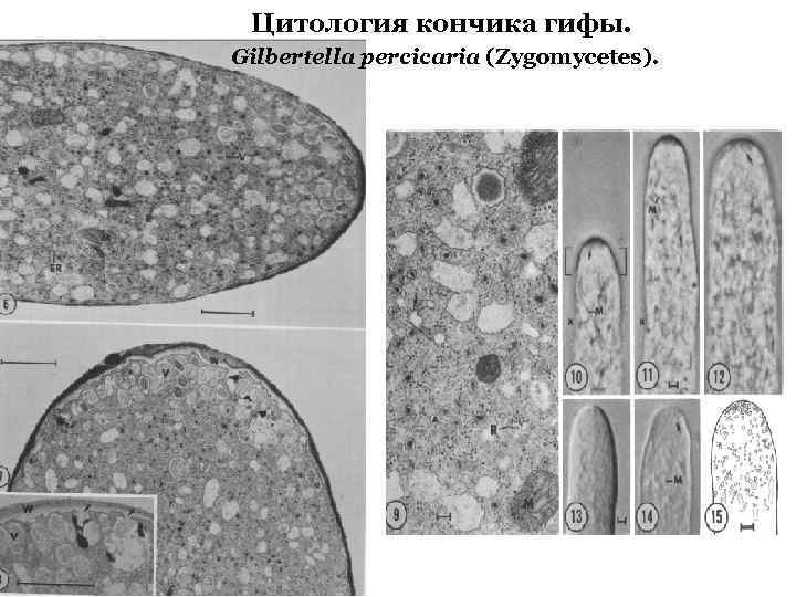 Цитология кончика гифы. Gilbertella percicaria (Zygomycetes). 