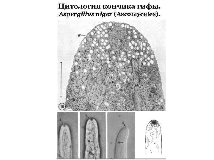 Цитология кончика гифы. Aspergillus niger (Ascomycetes). 