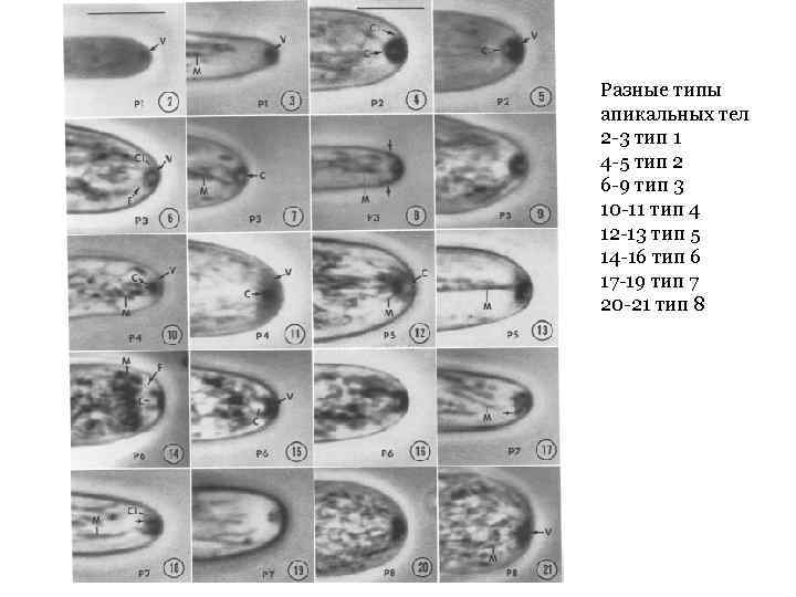 Разные типы апикальных тел 2 -3 тип 1 4 -5 тип 2 6 -9