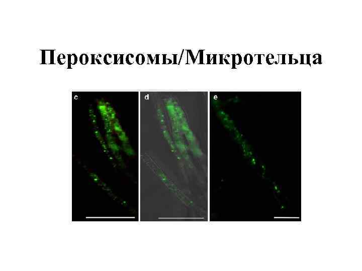 Пероксисомы/Микротельца 