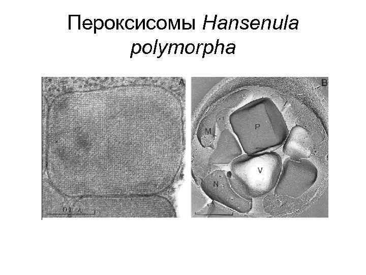 Пероксисомы Hansenula polymorpha 