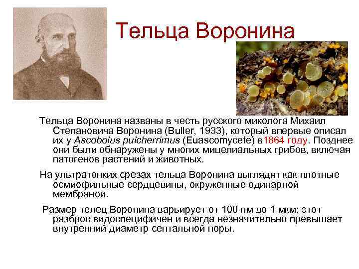 Тельца Воронина названы в честь русского миколога Михаил Степановича Воронина (Buller, 1933), который впервые