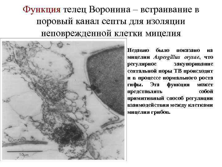 Функция телец Воронина – встраивание в поровый канал септы для изоляции неповрежденной клетки мицелия