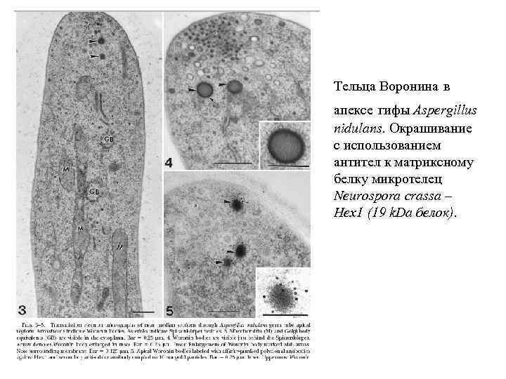 Тельца Воронина в апексе гифы Aspergillus nidulans. Окрашивание с использованием антител к матриксному белку