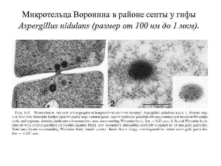 Микротельца Воронина в районе септы у гифы Aspergillus nidulans (размер от 100 нм до
